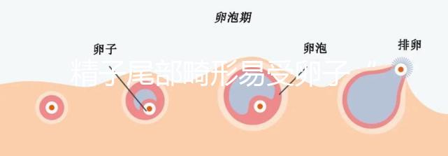 精子尾部畸形易受卵子“嫌棄”,無(wú)尾、短卷尾需重視