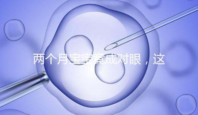 兩個月寶寶竟成對眼,這5大形成原因家長必知