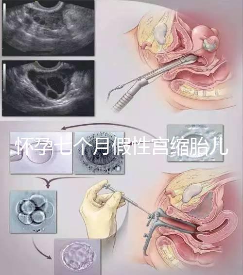 懷孕七個月假性宮縮胎兒可能缺氧，處理不好對胎兒影響大