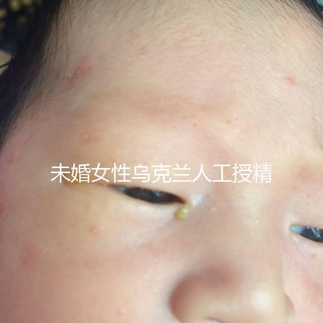 未婚女性烏克蘭人工授精必看!醫(yī)療及生活費(fèi)用明細(xì)預(yù)覽