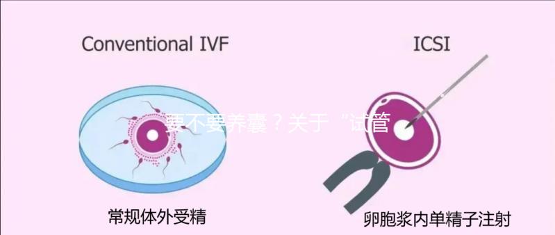 要不要養(yǎng)囊？關(guān)于“試管養(yǎng)囊”你是否會(huì)有很多問(wèn)號(hào)？