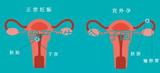 高齡產(chǎn)婦生八個(gè)孩子國(guó)家有補(bǔ)助？有沒(méi)有違法才是關(guān)鍵